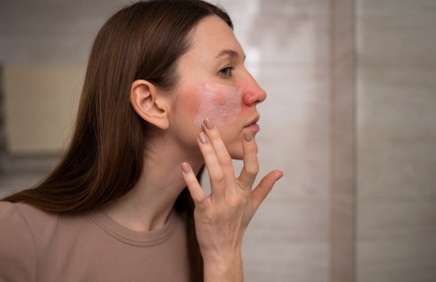 Yellowing Of The Skin